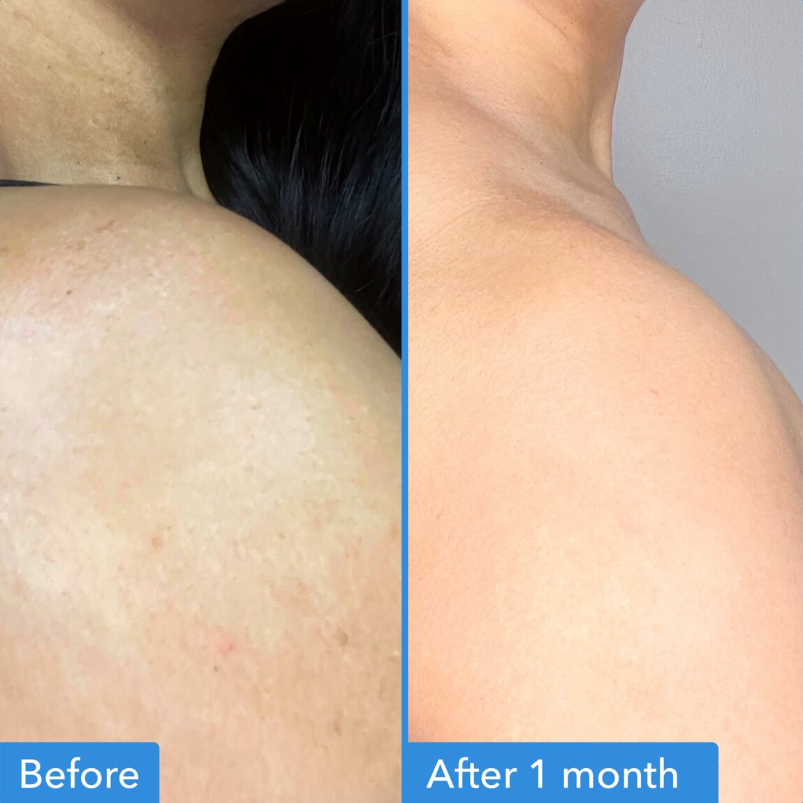 discoloration-correcting-body-treatment-l9 zb_p.jpg