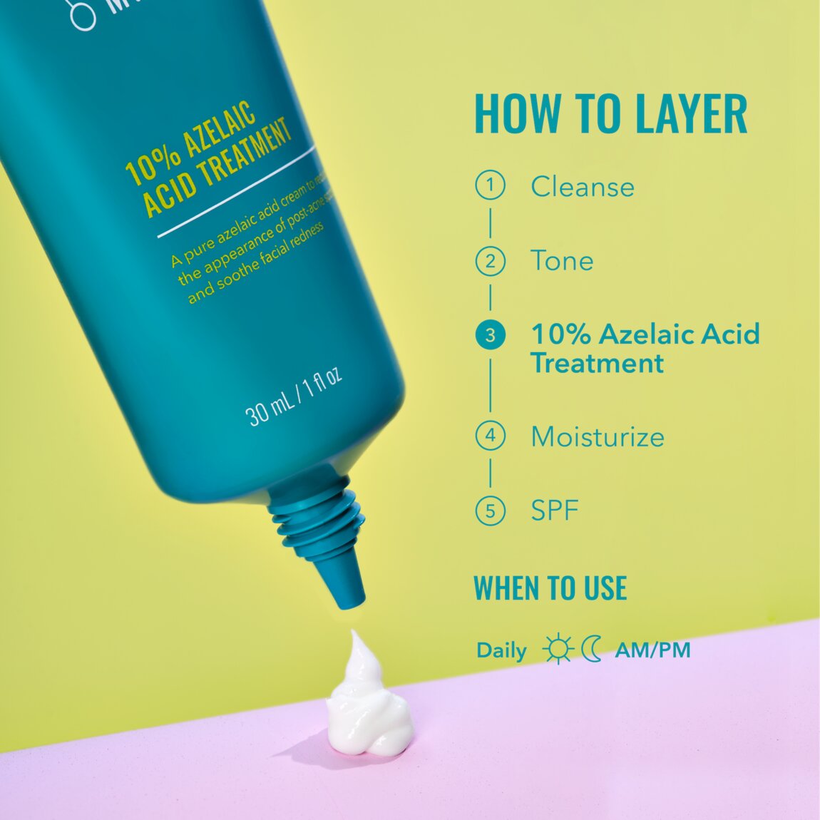 10-azelaic-acid-treatment-v3 zb_p.jpg