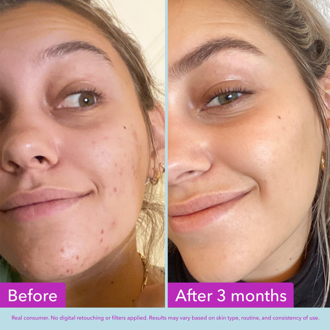 niacinamide-brightening-toner-g2 zb_p.jpg